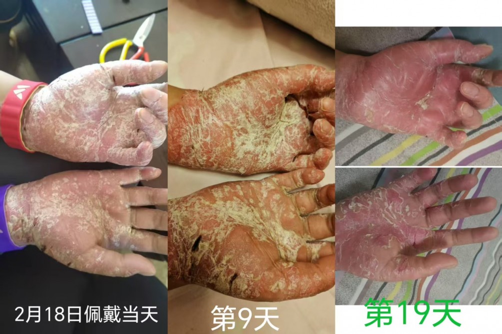 夥伴分享｜一段讓人很感動的改變 ❤️